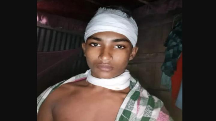 আমতলীতে মধ্যযুগীয় কায়দায় হাত-পা বেঁধে শিশু নির্যাতন, থানায় মামলা